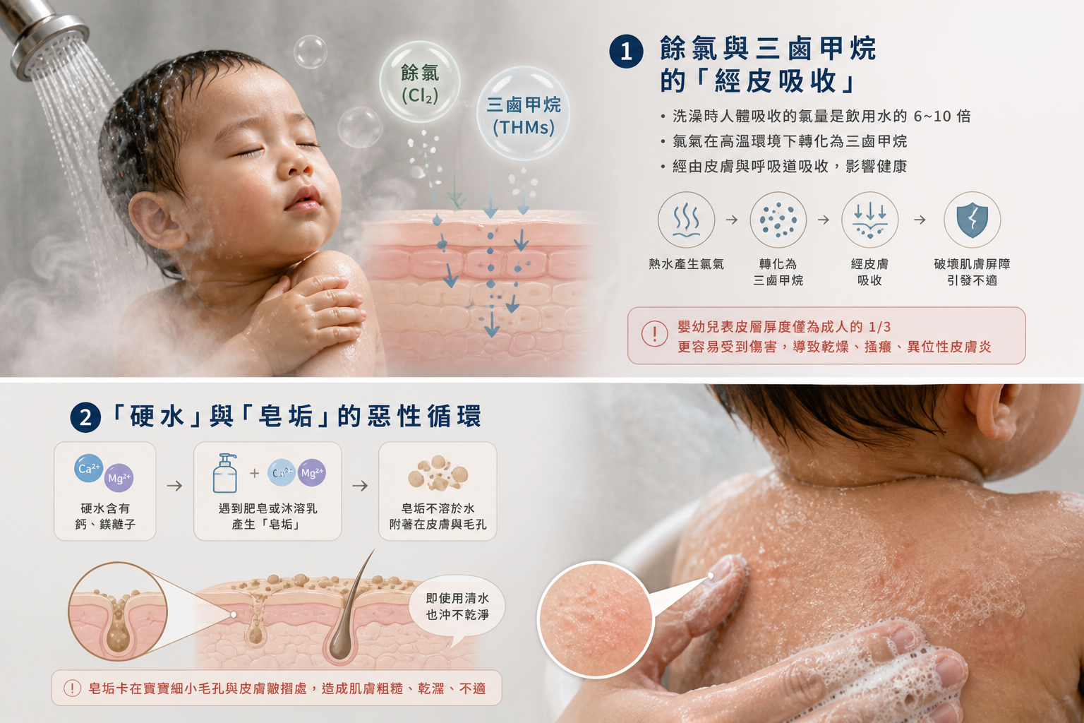 全家潔寶寶皮膚反覆紅癢好不了？除了乳液，你可能忘了這道「看不見」的守護：全戶淨水軟水案例施工或設備安裝現場照片